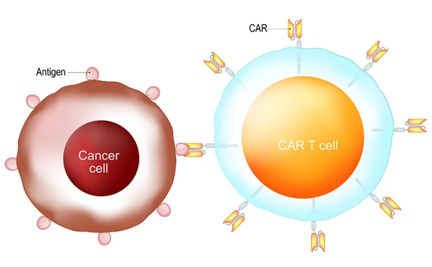 The Revolutionary Leap in CAR T-Cell Therapy: A Breakthrough in Cancer Treatment